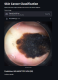 Skin Cancer Classification
