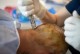 Dentist, Transplant and Rhinoplasty,