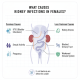 Kidney Infections in Females